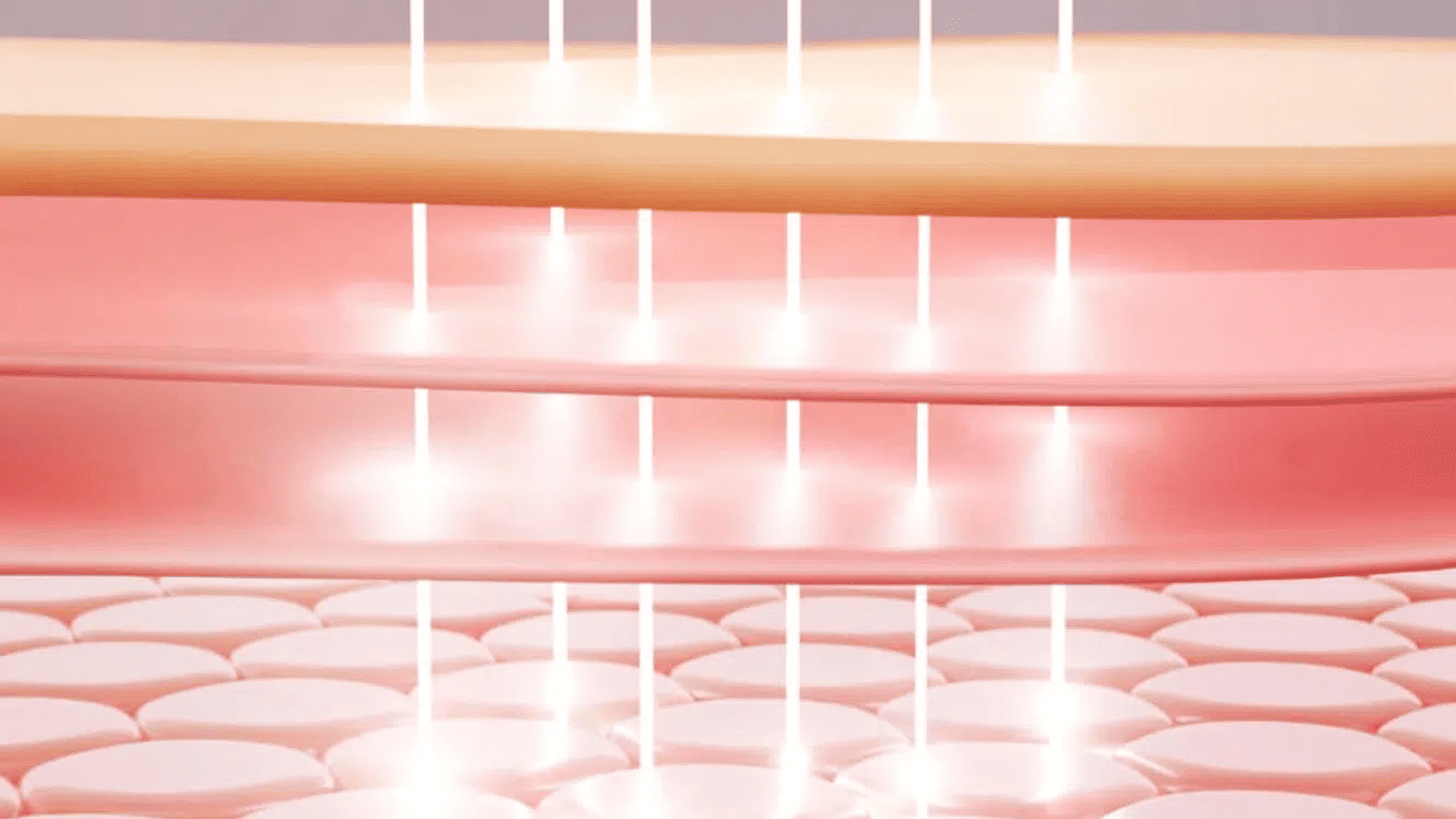 ultraclear laser treatment