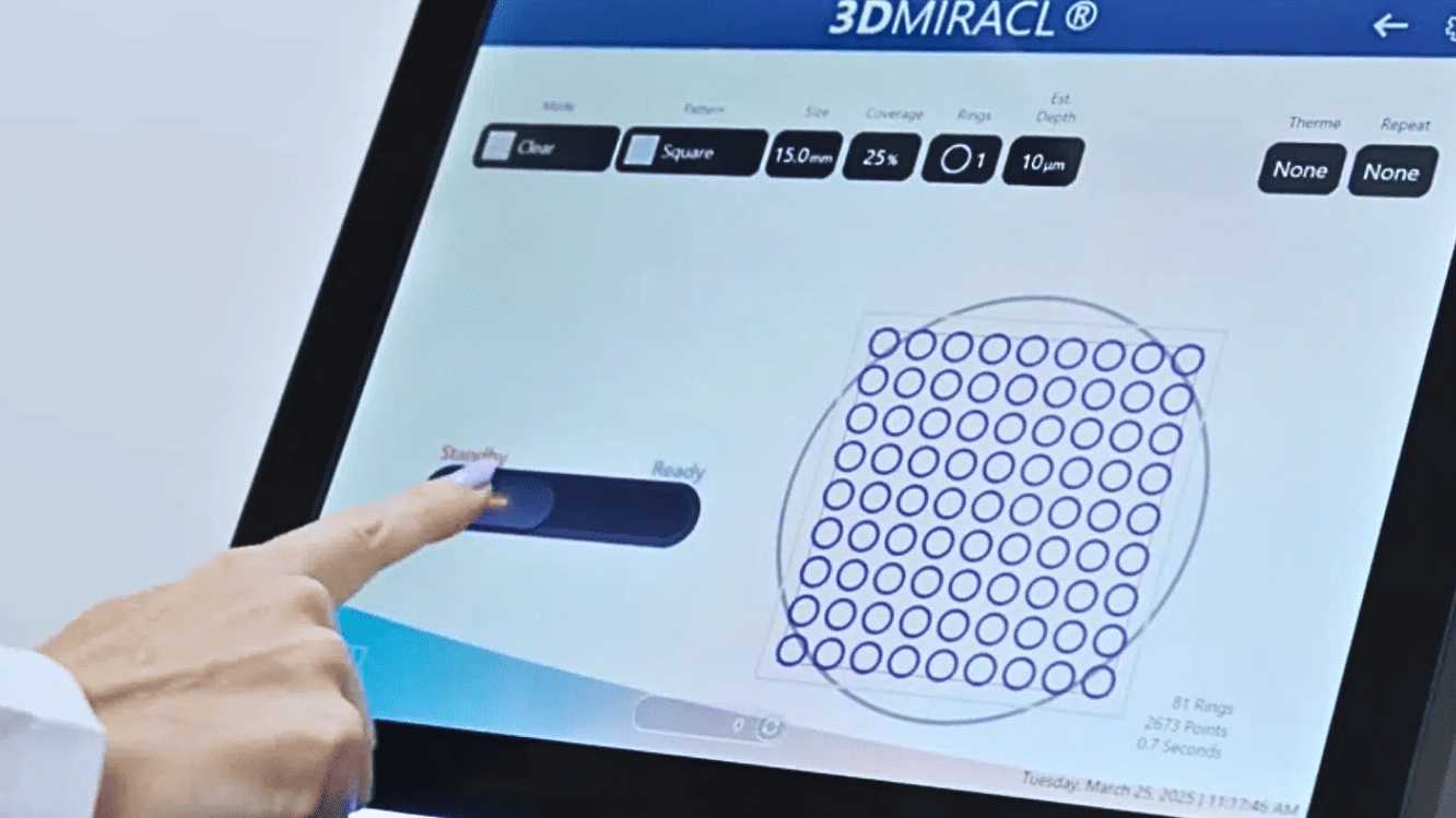 ultraclear laser treatment