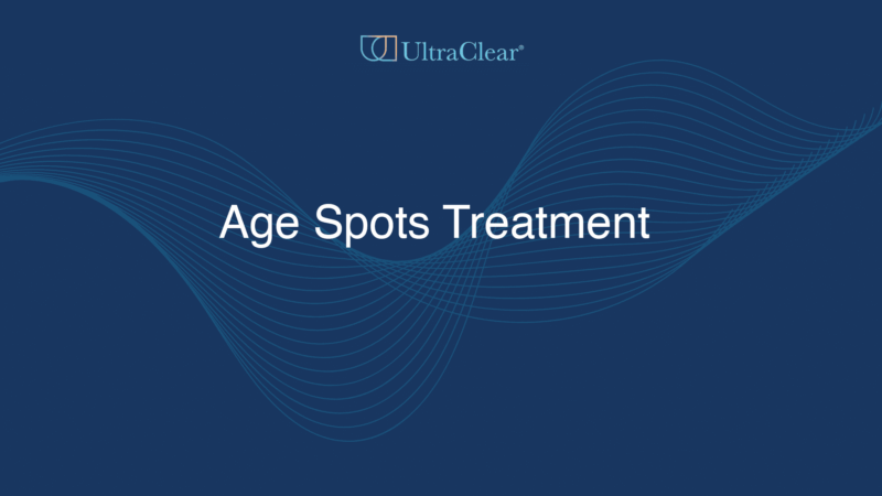 Age Spots Treatment