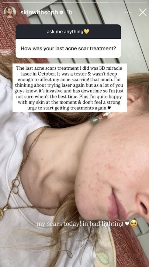 Sophie Dove’s story featuring UltraClear®