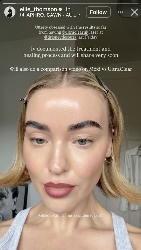 Ellie Thompson’s story featuring UltraClear®