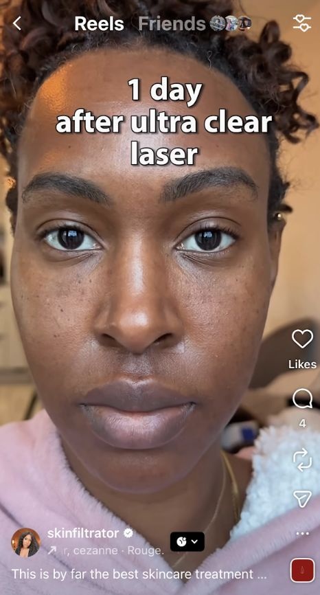 Monique Ferguson’s post featuring UltraClear®