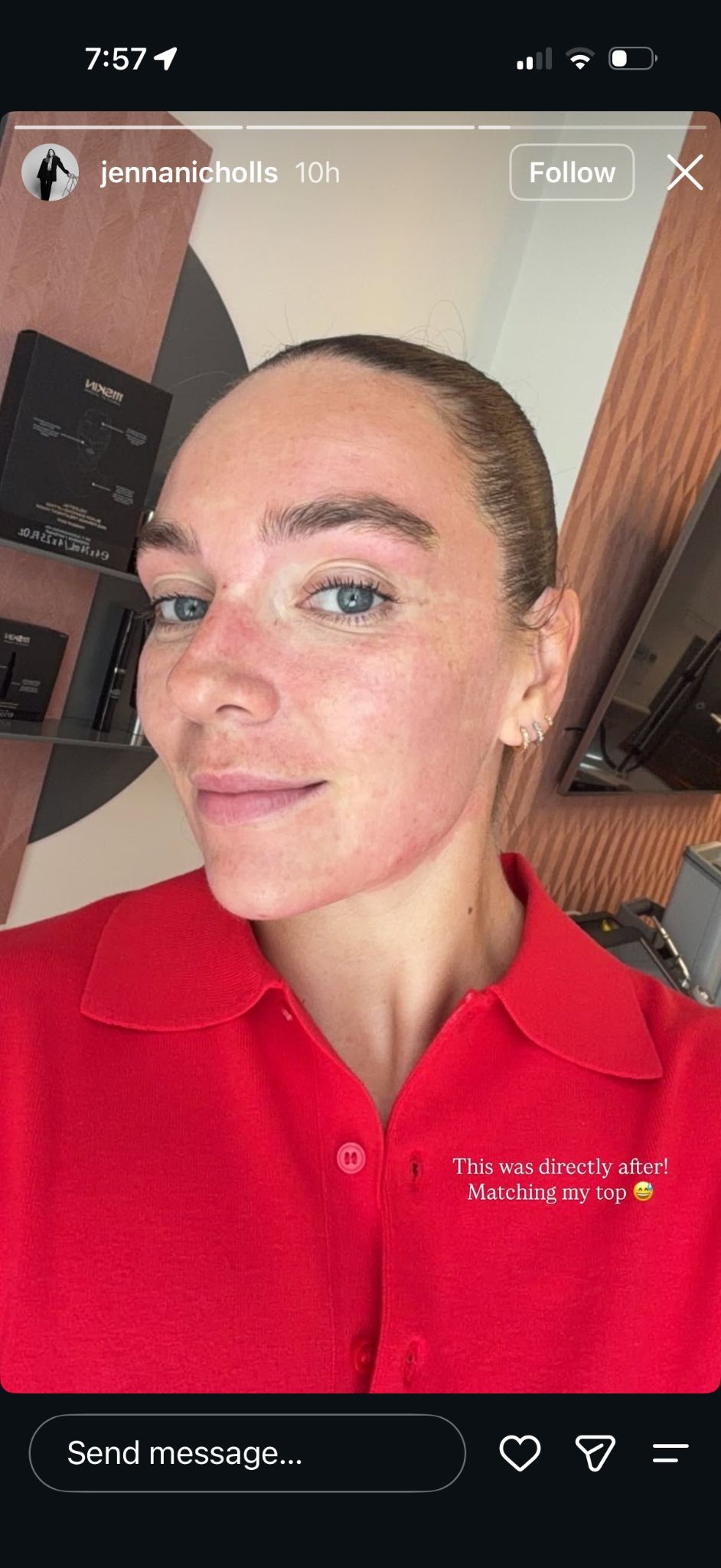 Jenna Nichollas’s September UltraClear treatment story 1