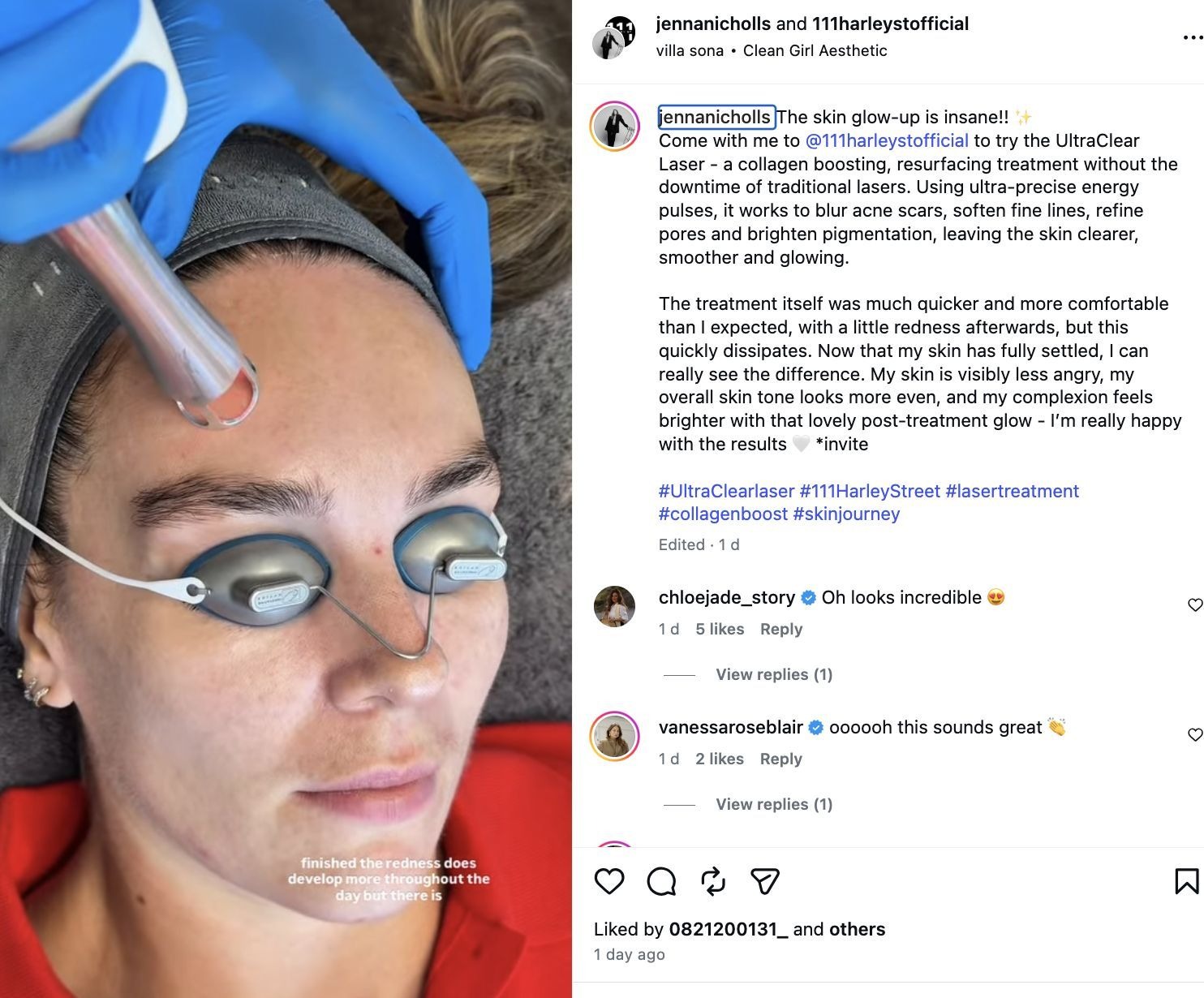 Jenna Nichollas’s UltraClear treatment post at 111 Harley Street
